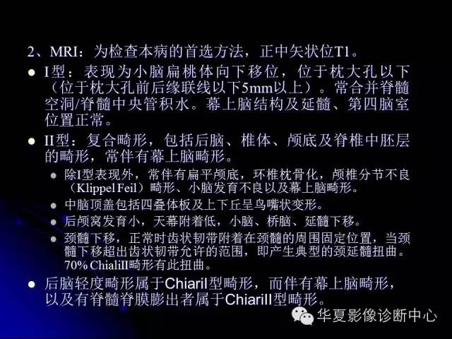 【PPT】颅脑先天发育畸形