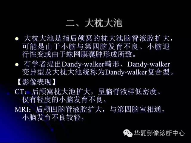 【PPT】颅脑先天发育畸形