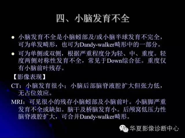 【PPT】颅脑先天发育畸形