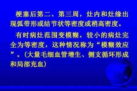 脑梗塞的CT/MRI诊断