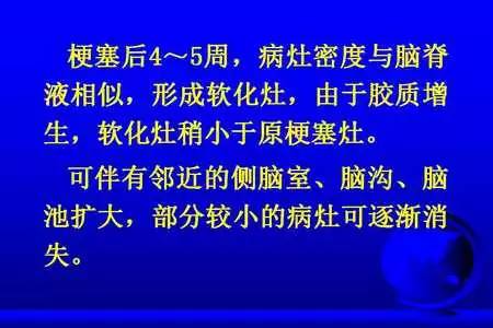 脑梗塞的CT/MRI诊断