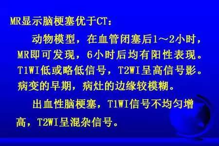 脑梗塞的CT/MRI诊断