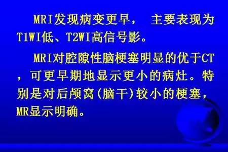 脑梗塞的CT/MRI诊断