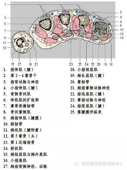 手指磁共振断层解剖+详细标注