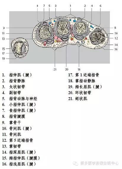 手指磁共振断层解剖+详细标注