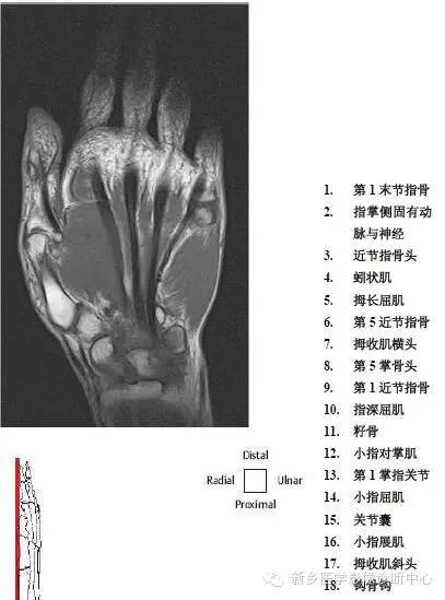手指磁共振断层解剖+详细标注