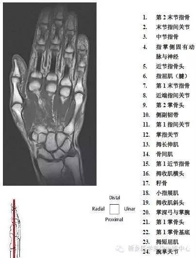 手指磁共振断层解剖+详细标注