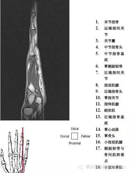 手指磁共振断层解剖+详细标注