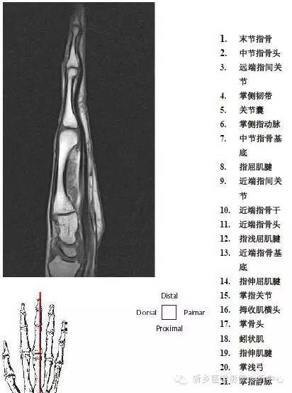 手指磁共振断层解剖+详细标注