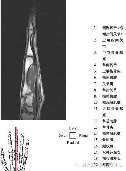 手指磁共振断层解剖+详细标注