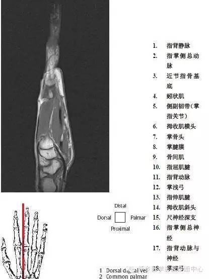 手指磁共振断层解剖+详细标注
