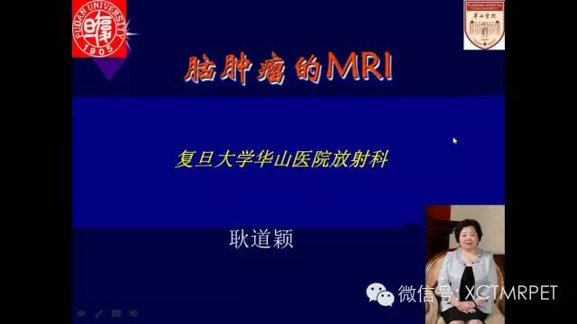 脑肿瘤的MRI
