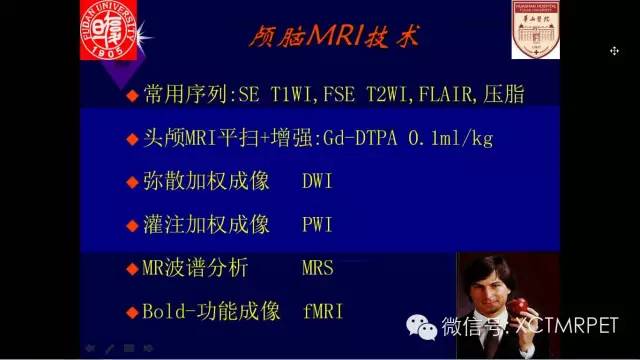 脑肿瘤的MRI