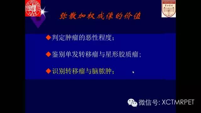 脑肿瘤的MRI