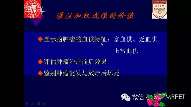 脑肿瘤的MRI