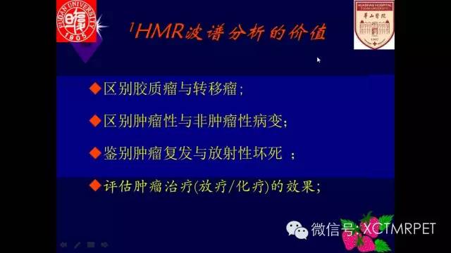 脑肿瘤的MRI