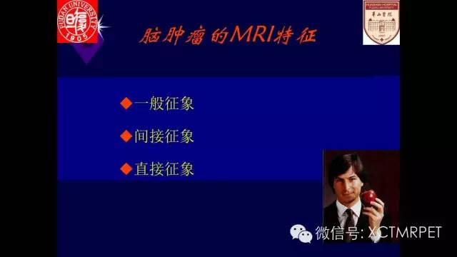 脑肿瘤的MRI