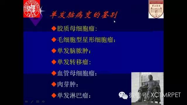 脑肿瘤的MRI