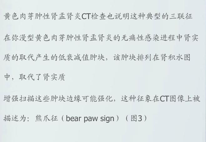 泌尿系统疾病典型征象