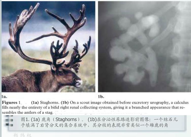 泌尿系统疾病典型征象