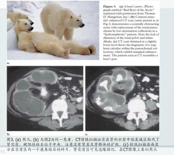 泌尿系统疾病典型征象