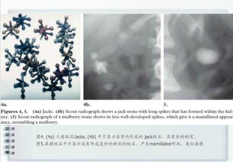 泌尿系统疾病典型征象