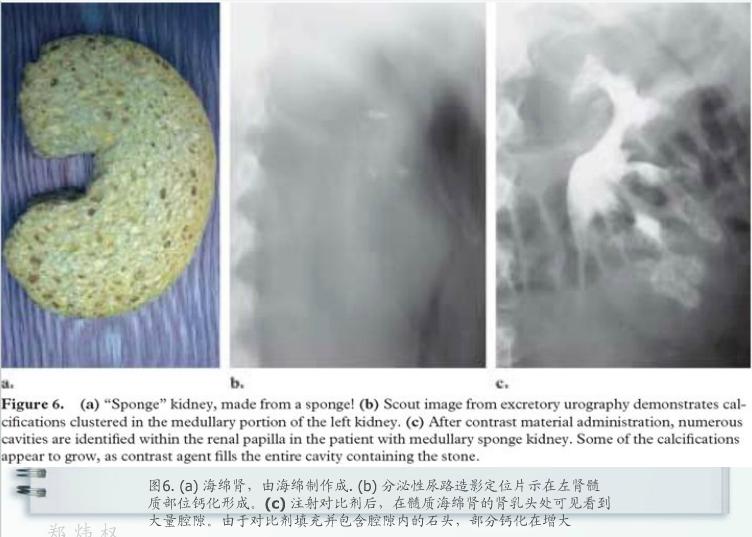 泌尿系统疾病典型征象