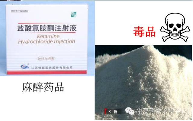 【病例】氯胺酮(K粉)相关性膀胱炎1例CT及MR影像表现 【病例】氯胺酮(K粉)相关性膀胱炎1例CT及MR影像表现