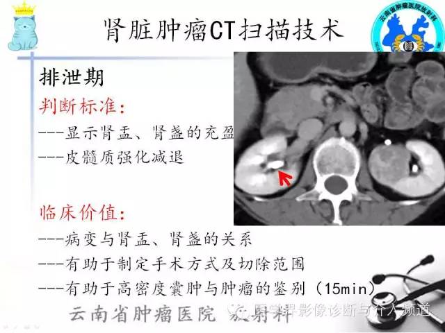 肾脏肿瘤CT扫描技术