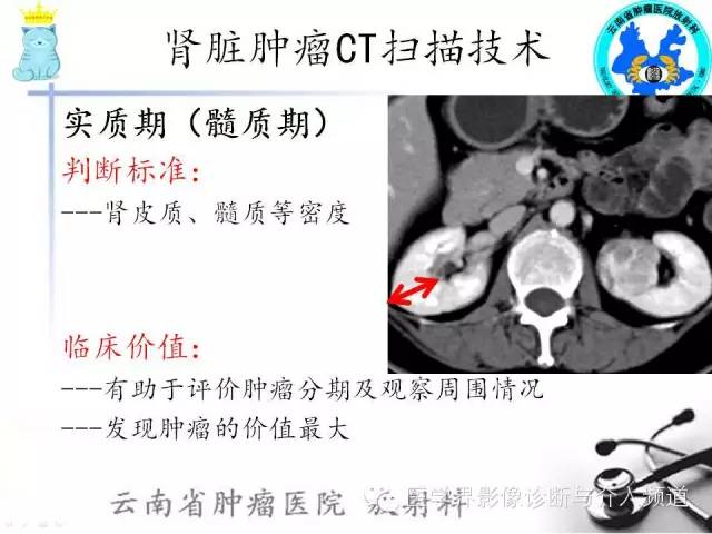 肾脏肿瘤CT扫描技术