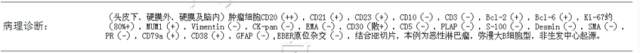 【病例】颅骨恶性淋巴瘤1例MR影像表现 【病例】颅骨恶性淋巴瘤1例MR影像表现