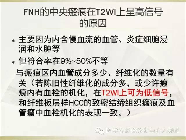 【PPT】肝脏局灶性结节性增生FNH的影像学诊断与鉴别诊断
