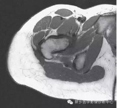 髋关节解剖 详细标注