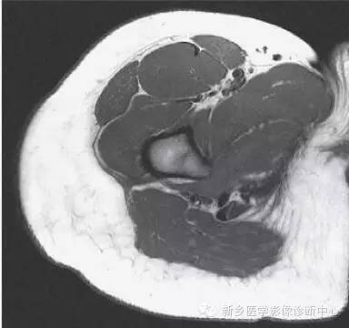 髋关节解剖 详细标注