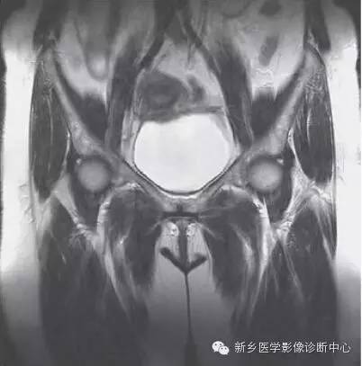 髋关节解剖 详细标注