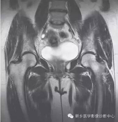 髋关节解剖 详细标注