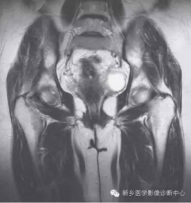 髋关节解剖 详细标注
