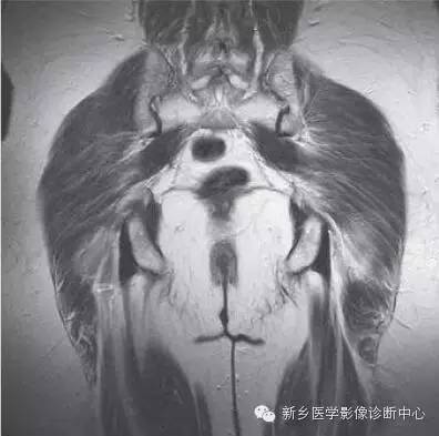 髋关节解剖 详细标注
