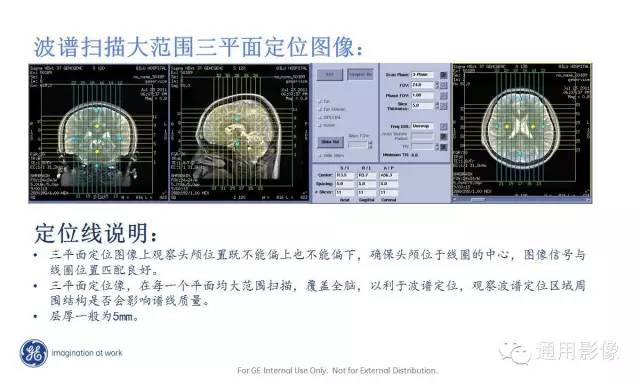 中枢神经系统波谱MRS