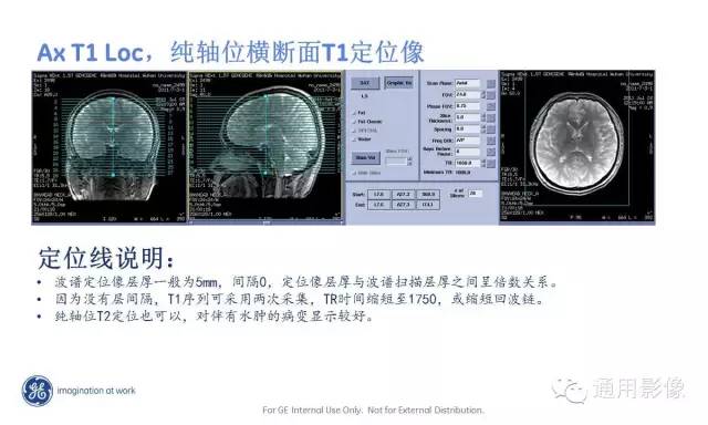 中枢神经系统波谱MRS