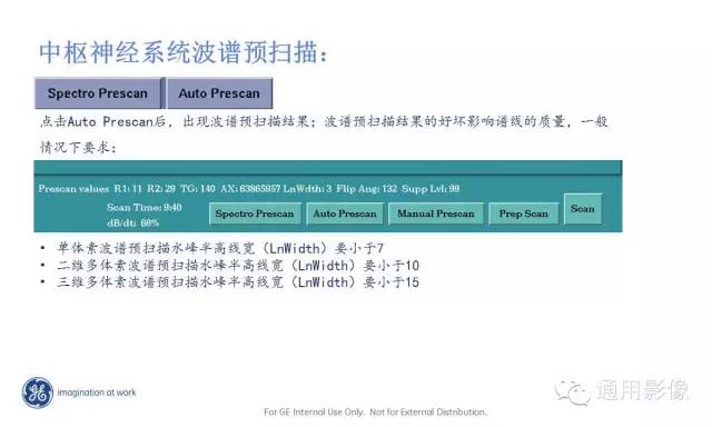 中枢神经系统波谱MRS