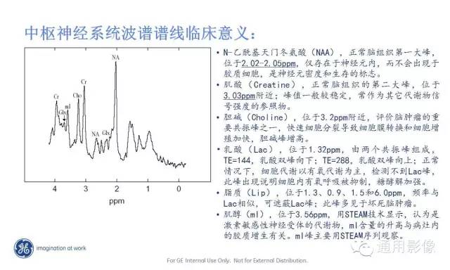 中枢神经系统波谱MRS