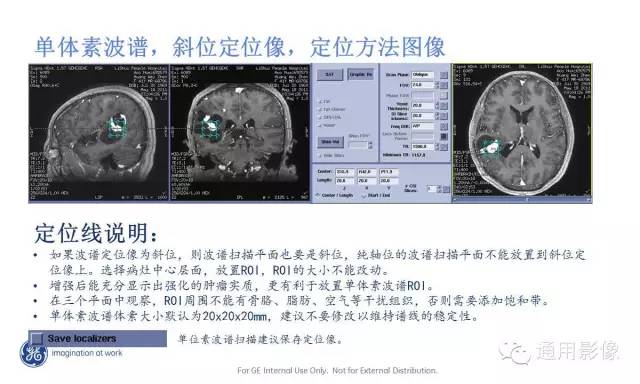 中枢神经系统波谱MRS