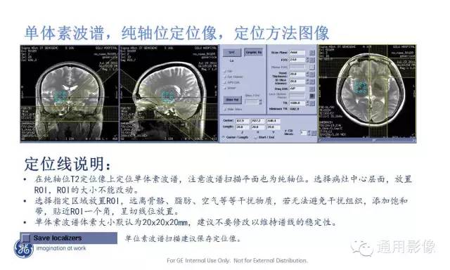 中枢神经系统波谱MRS