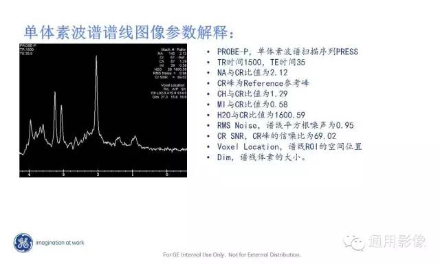 中枢神经系统波谱MRS