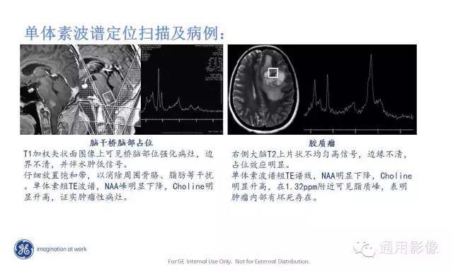 中枢神经系统波谱MRS