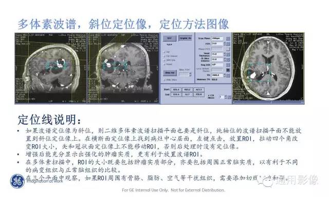 中枢神经系统波谱MRS