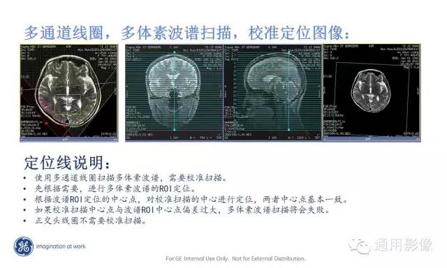 中枢神经系统波谱MRS