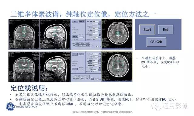 中枢神经系统波谱MRS