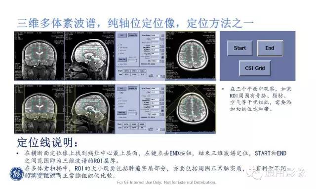 中枢神经系统波谱MRS